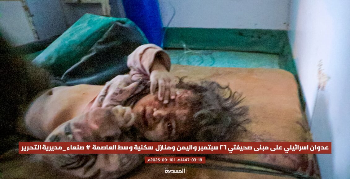 صنعاء عدوان استهداف صحيفة سبتمر